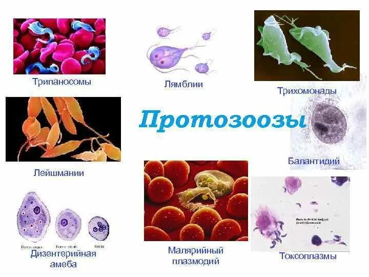 Выберите паразитических простейших ответ. Лямблия лейшмания трихомонада. Лейшмания лямблия малярийный плазмодий. Лейшмании, трипаносомы, лямблии, трихомонады. Дизентерийная амеба и малярийный плазмодий.