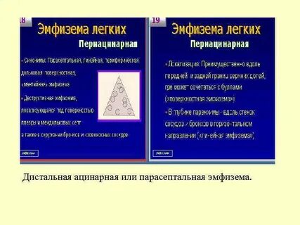 Парасептальная эмфизема