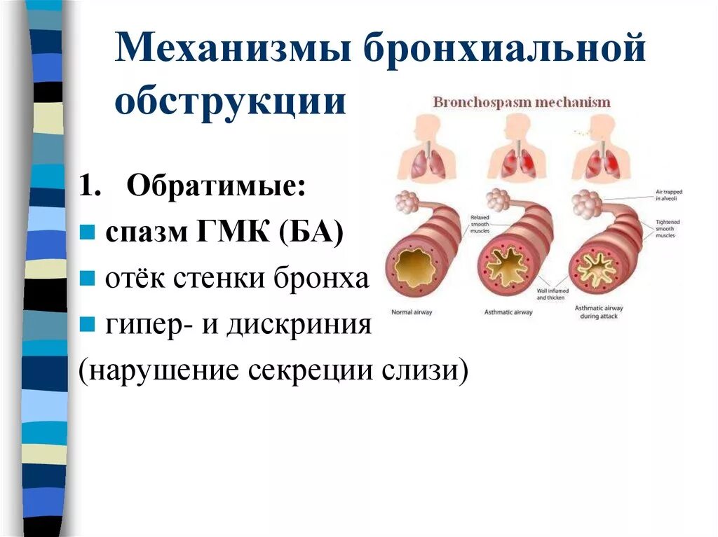 Картинки ОБСТРУКТИВНАЯ ДЫХАТЕЛЬНАЯ