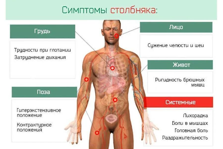 Симптомы столбняка у человека