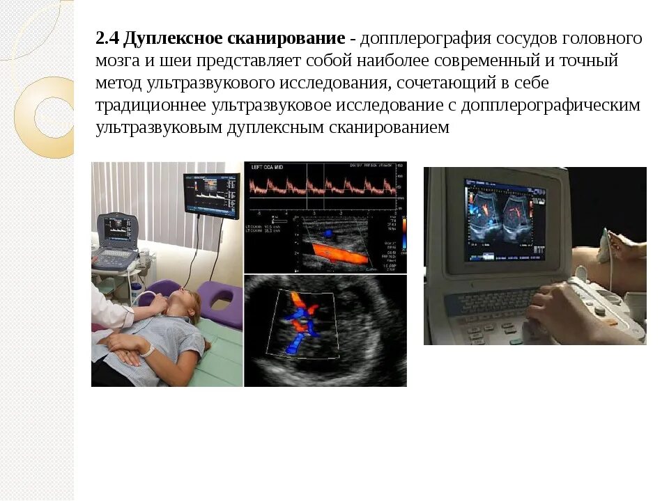 Что такое уздг. Ультразвуковая допплерография сосудов головного мозга. Исследования головного мозга ультразвуковая допплерография. Допплеровское сканирование кровеносных сосудов. УЗДГ допплер сосудов головы.