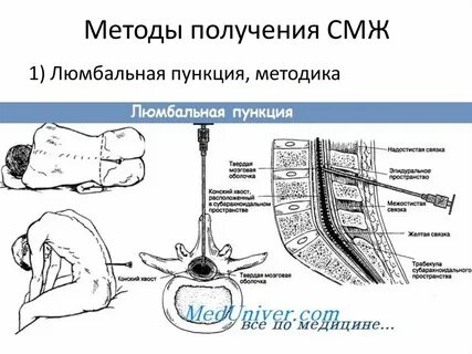 После пункции что делать