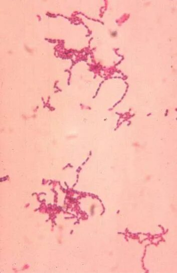 Пептококки нигер. Peptococcus микробиология. Peptostreptococcus anaerobius. Peptostreptococcus anaerobius по грамму.