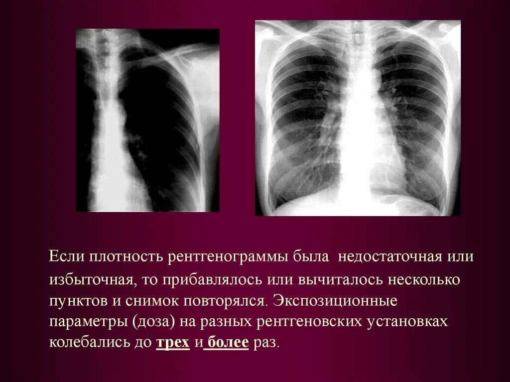 Рентгенограмма суть