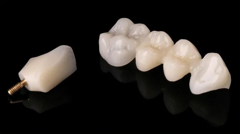 Диксид циркониякоронка. Диоксид циркония на жевательные зубы. Безметалловая коронка zro2 по технологии cad/cam. Диоксид циркония на жевательные зубы. Emax или диоксид циркония.