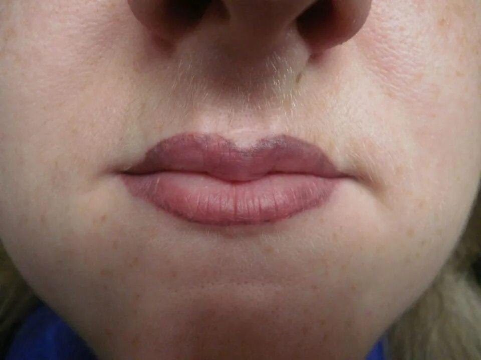 Перманентный макияж губ. Неудачный перманентный макияж губ. Ужасный перманентный макияж губ. Губы выходят за контур