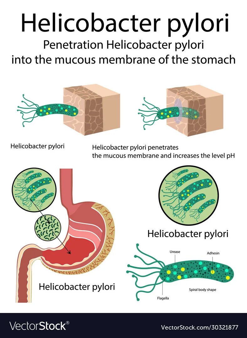 Причины появления хеликобактер в желудке. Helicobacter h175. Helicobacter pylori вырабатывает фермент. Хеликобактер пилори Vektor. Helicobacter pylori микроскопия.