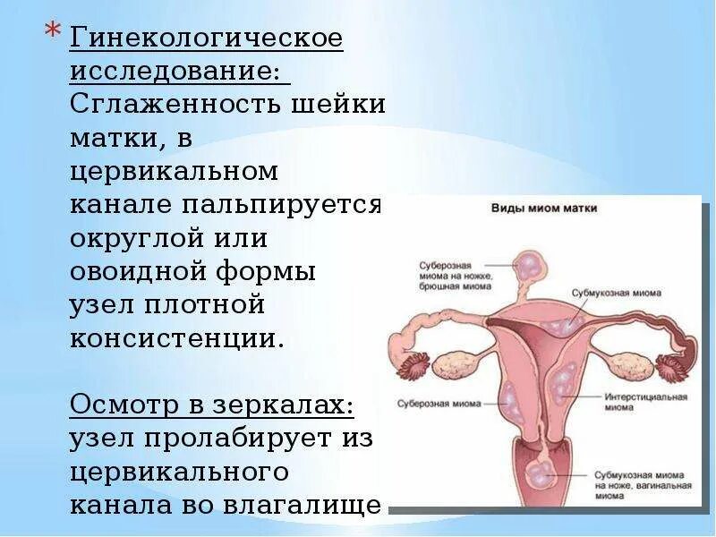 Формы миомы матки. Миома матки гинекологическое исследование. Миома в цервикальном канале.