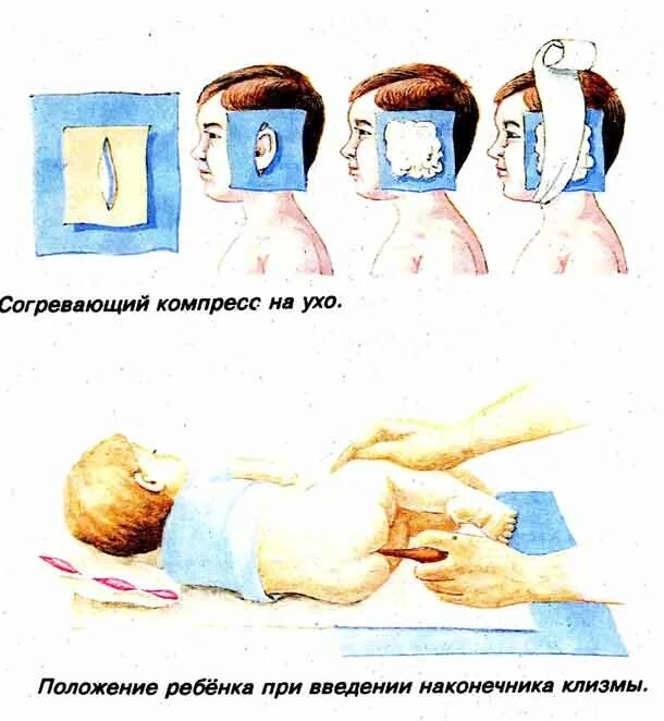 Спиртовой компресс на ухо