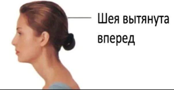Песков о выборах 2024. Ее как то выдвинули на. Осанка шея выдвинута вперед. Ее как то выдвинули на. Ее как то выдвинули на.