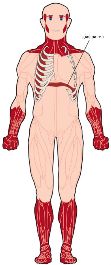 Ослабление мышц. Muscle diseases. Волокна мышц. Напряжённые мышцы. Muscular dystrophy diseases.