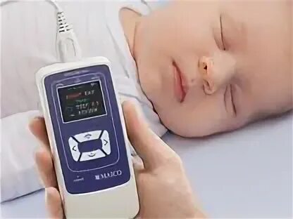 Прибор отоакустической эмиссии. Аудиологический скрининг новорожденных. Аудиологический скрининг новорожденных аппарат. Аппарат для аудиологического скрининга. ОАЭ аудиологический скрининг.