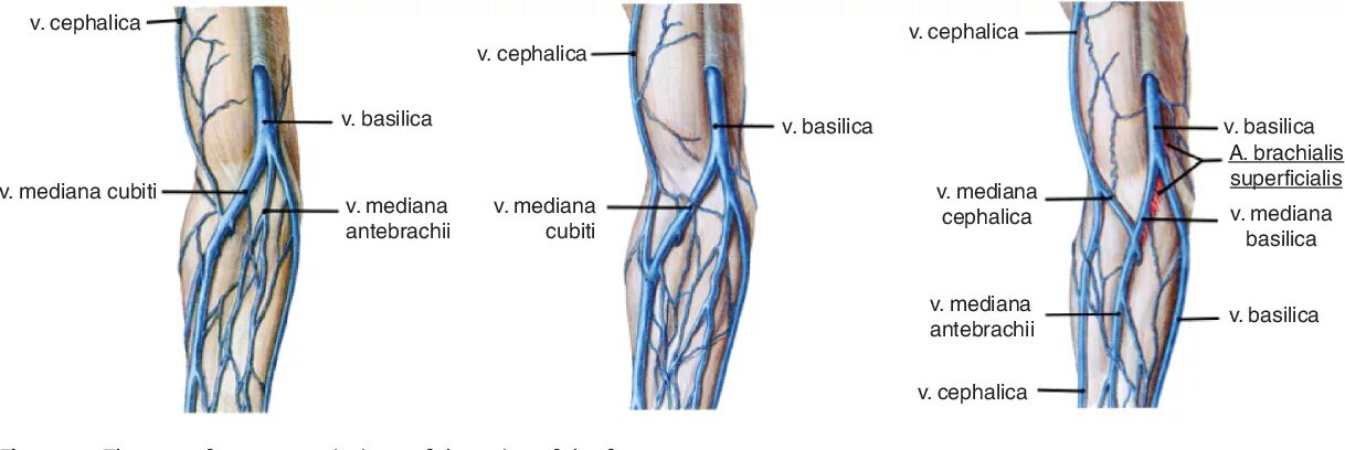 Алтах вена. Вена cephalica анатомия. Вены предплечья анатомия схема. Медиальная подкожная Вена руки v. Basilica. Поверхностные вены верхней конечности анатомия.