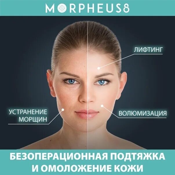 Морфеус 8 отзывы фото до и после Морфеус 8 до и после фото: найдено 82 изображений