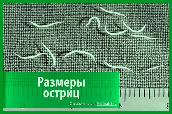 Острицы у взрослых симптомы и лечение препараты. Острицы лечение у взрослых самое эффективное средство. острицы у взрослых симптомы.