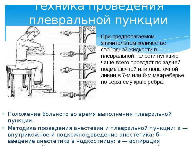 Техника выполнения плевральной пункции. Диагностическая плевральная пункция алгоритм. Плевральная пункция (торакоцентез). Набор для пункции плевральной полости алгоритм. Набор для плевральной пункции алгоритм Сестринское дело.