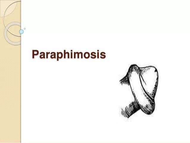 Что такое парафимоз. Парафимоз презентация. Парафимоз у детей. Парафимоз у детей симптомы.