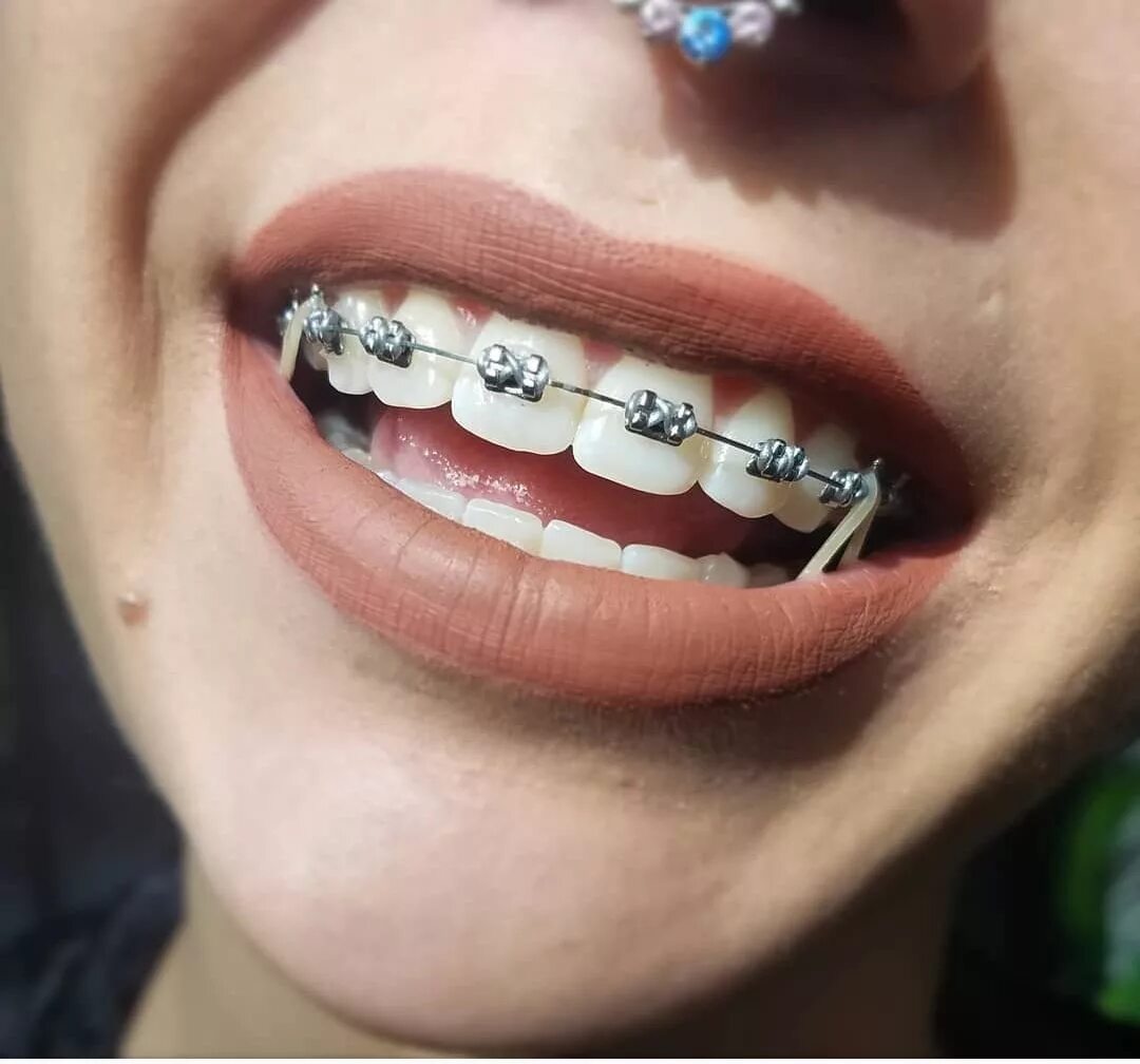 Matching brackets