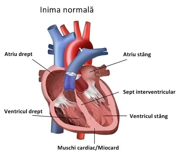 Какая кровь в левом желудочке сердца. Синдром спортивного сердца. Спортивное сердце. Сердце спортсмена отличие от здорового. Выброс крови из левого желудочка.