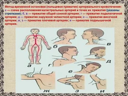 Места остановки кровотечения пальцевым прижатием