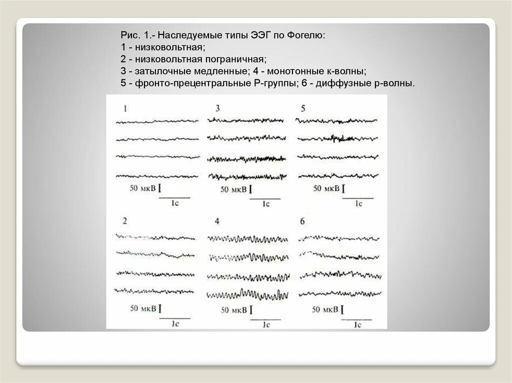 Направление на ЭЭГ. Направление на ЭЭГ образец. Трехфазные волны на ЭЭГ. Тематический план по ЭЭГ. Медленные волны на ээг