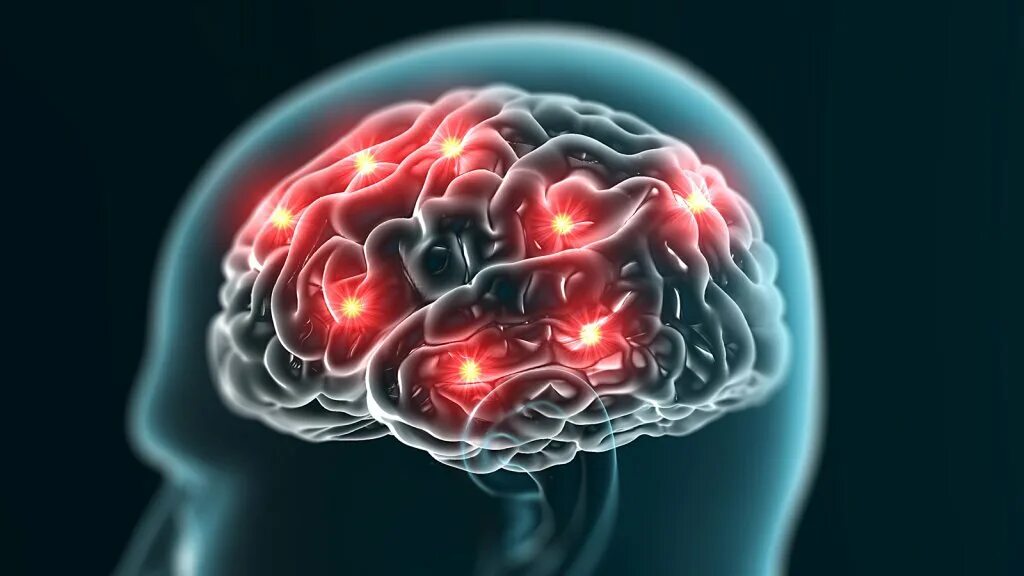 Brain down. Неврология мозг. Визуализация мозга. Мыслительный мозг.