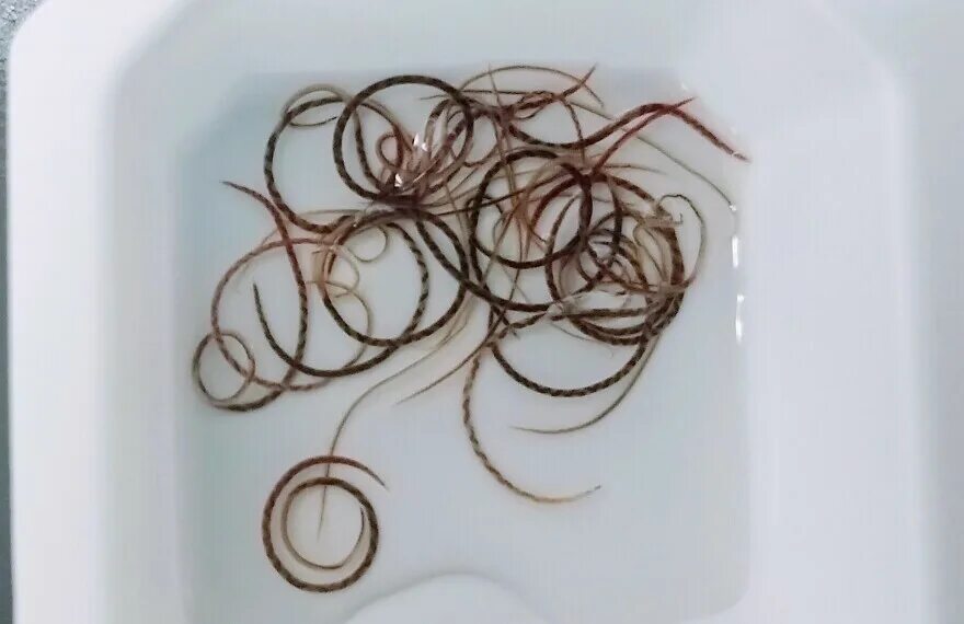 Angiostrongylus cantonensis у человека. Паразит angiostrongylus cantonensis. Angiostrongylus cantonensis. Нематода ангиостронгилез. Angiostrongylus cantonensis.