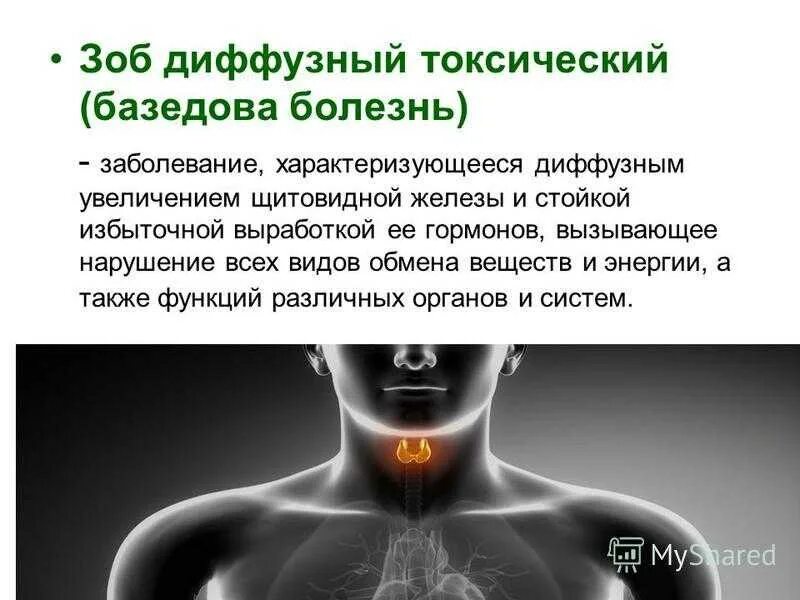 Диффузный зоб опасен. Эндемический зоб и базедова болезнь. гипофункция щитовидной железы эндемический зоб. диффузный тиреотоксический зоб.