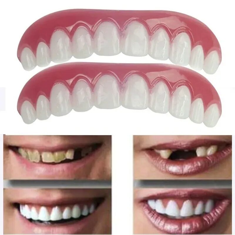 Какие можно сделать зубы. Виниры для зубов snapon smile (белый). силиконовые вставные зубы. вставные зубы пластмассовые. вставные накладные зубы.