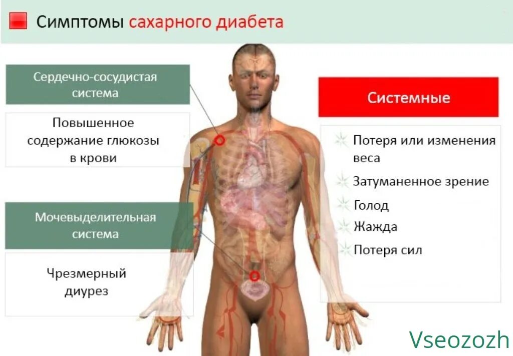 Сахарный диабет ранние симптомы у женщин. Сахарный диабет симптомы. Симптломы.сахарногодиабета. Проявление сахарного диабета. Сахарный диабет симптомы у мужчин.