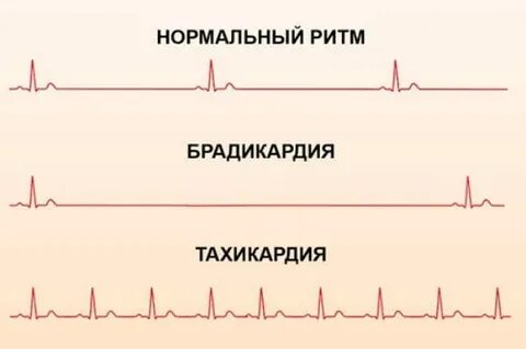 Сердцебиение побочный эффект