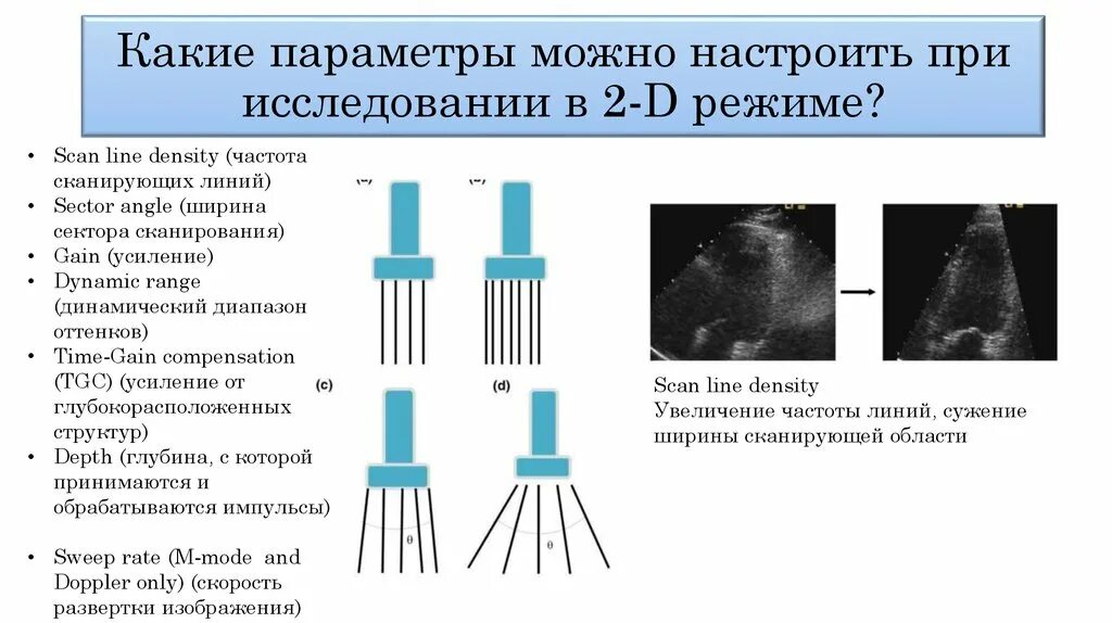 Датчики используемые для эхокардиографии. Датчик для ЭХОКГ частота. Основные типы ультразвуковых датчиков.