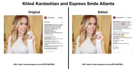 Express Smile Atlanta 