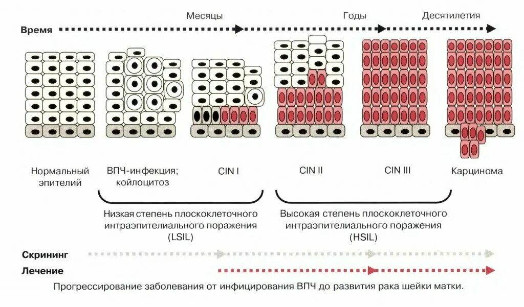 Тяжелая дисплазия шейки матки это. Дисплазия шейки матки HPV. Дисплазия 1-2 степени шейки. Дисплащиятшейки матки.