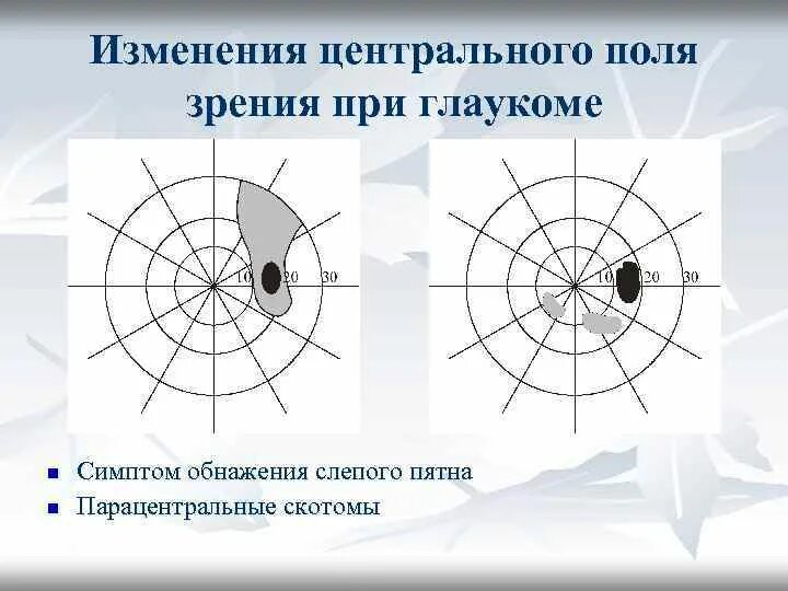 Скотома Бьеррума. Центральные скотомы в поле зрения. Слепое пятно это скотома. Центральная скотома периметрия. Центральное поле зрения