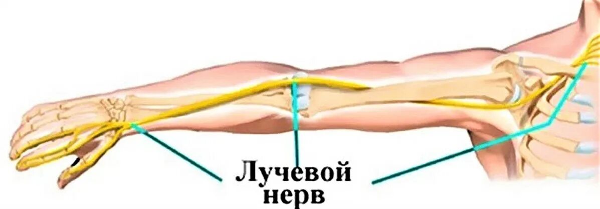 Туннельная нейропатия. Нейропатия лучевого нерва. Невропатия лучевого нерва анатомия. Невропатия лучевого нерва, нейропатия лучевого нерва. Локтевой нерв анатомия защемление.