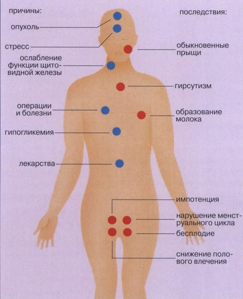 Пролактин симптомы у женщин. Повышенный пролактин у женщин. высокий пролактин у женщин. повышение пролактина у женщин симптомы. повышенный пролактин у женщин симптомы.