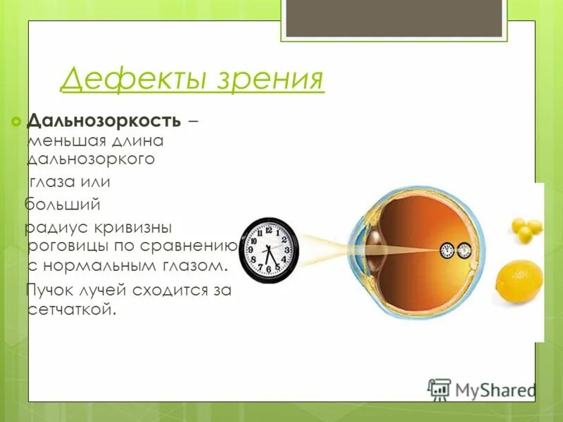 Дефекты зрения. Дефекты зрения. Глаз дефекты зрения презентация. Глаз дефекты зрения презентация. Строение глаза дефекты зрения физика.