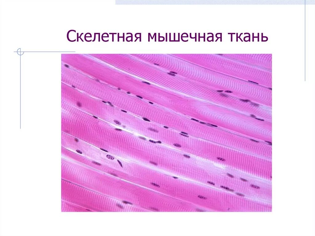 Регенерация поперечно полосатой скелетной мышечной ткани. Мышечная ткань окраска железным гематоксилином. Поперечно полосатая мышечная ткань структура. Строение поперечно полосатой скелетной мышечной ткани. Имеет поперечнополосатую мышечную ткань.