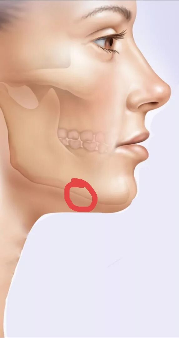 Шишка под подбородком болит. Шишка под челюстью болит.