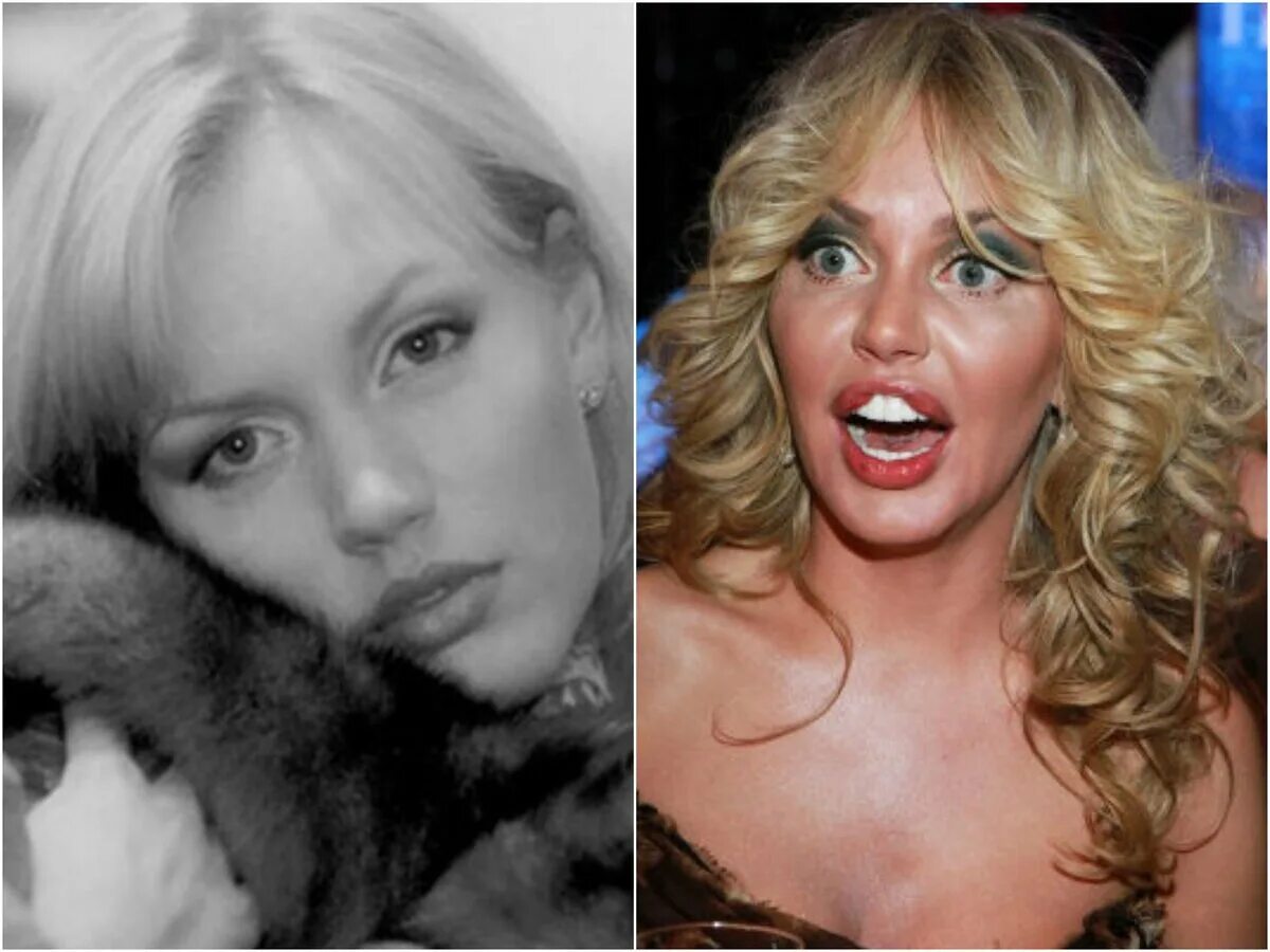 Малиновская маша до операций. Малиновская до и после пластики. Маша малиновская до пластики. Маша малиновская пластика 2022. Маша малиновская пластика.