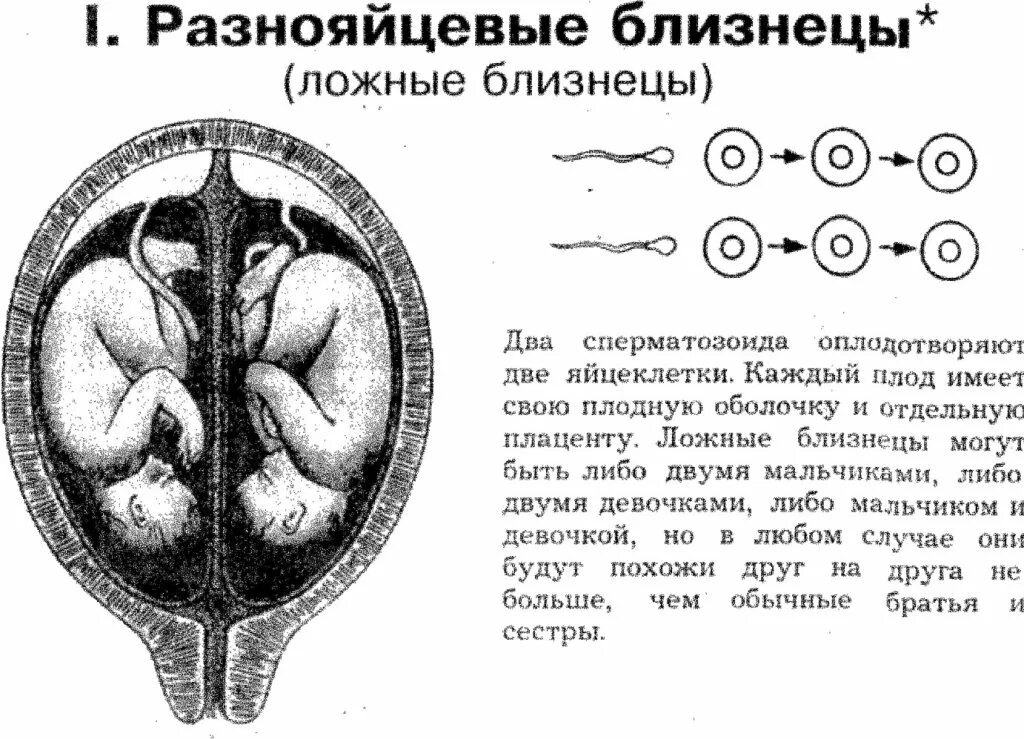 Совпадение признаков у однояйцевых и разнояйцевых близнецов