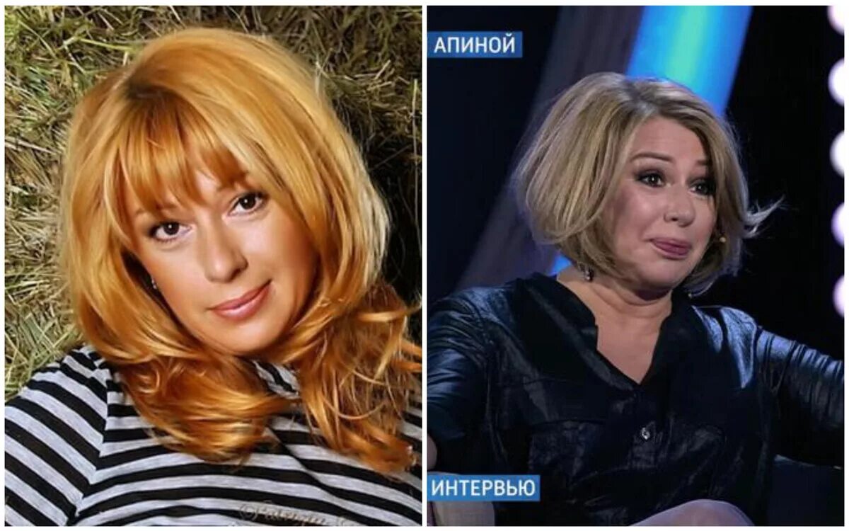 Алена Апина до и после пластики, фото в молодости и сейчас