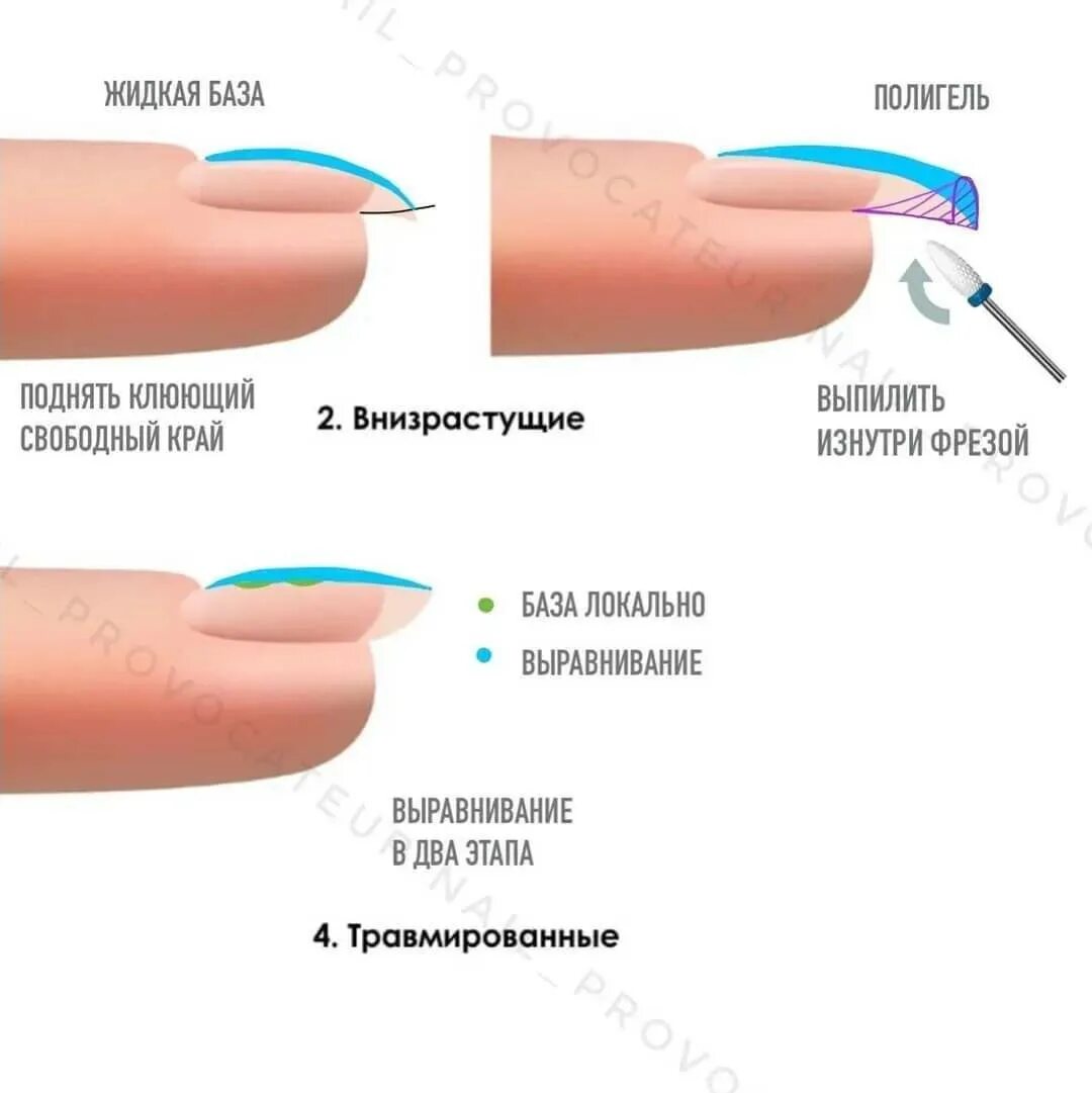 Не держится покрытие на ногтях. Правильная форма ногтя вид сбоку. Схема выравнивания ногтевой пластины гелем. Правильная форма нарощенных ногтей вид сбоку. Выравнивание ногтей сбоку.