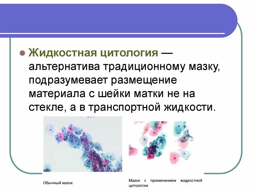 Что такое жидкостная цитология шейки матки