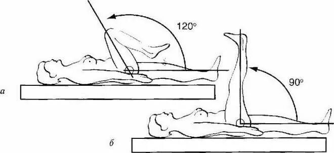 Сколько можно сидеть после операции. Гониометрия тазобедренного сустава. Угол сгибания тазобедренного сустава. Флексия тазобедренного сустава. Разгибание коленного сустава в градусах.