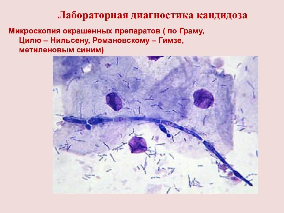 Микроскопия окрашенных