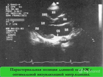 Эхо кг в новокузнецке