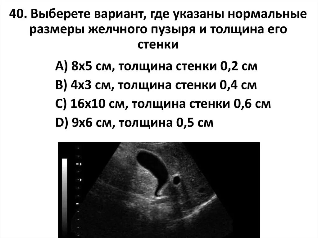 4 размера печени. Толщина стенки желчного пузыря на УЗИ. Стенка желчного пузыря норма на УЗИ. УЗИ норма толщина желчного пузыря. Толщина стенки желчного пузыря по УЗИ.