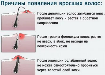 Может ли появиться